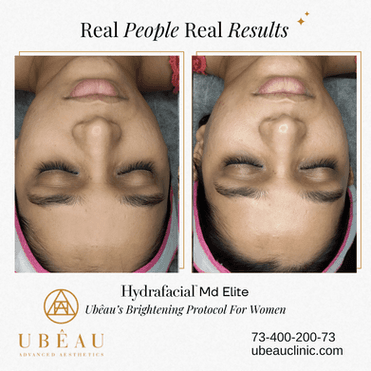 Skin transformation result 1