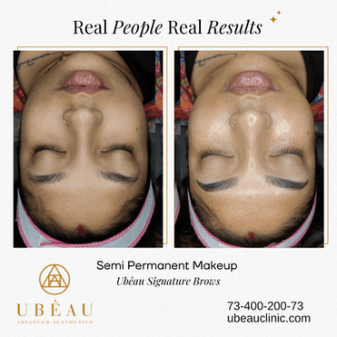 Skin transformation result 2